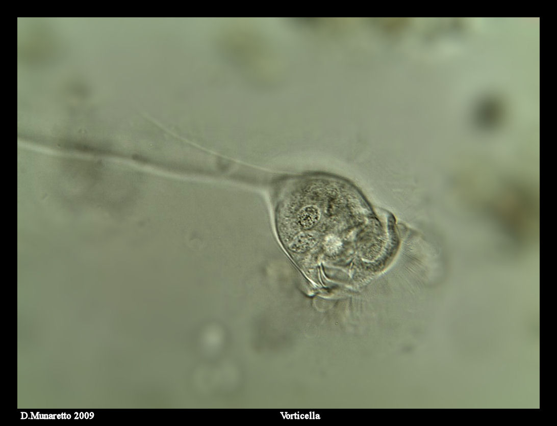 Vorticella...